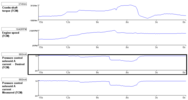 Filename : p0960 p0961_6.png
Filesize : 10KB
Dimensions : 950x505
Date added : Apr 07, 2020 p0960 p0961_6.png